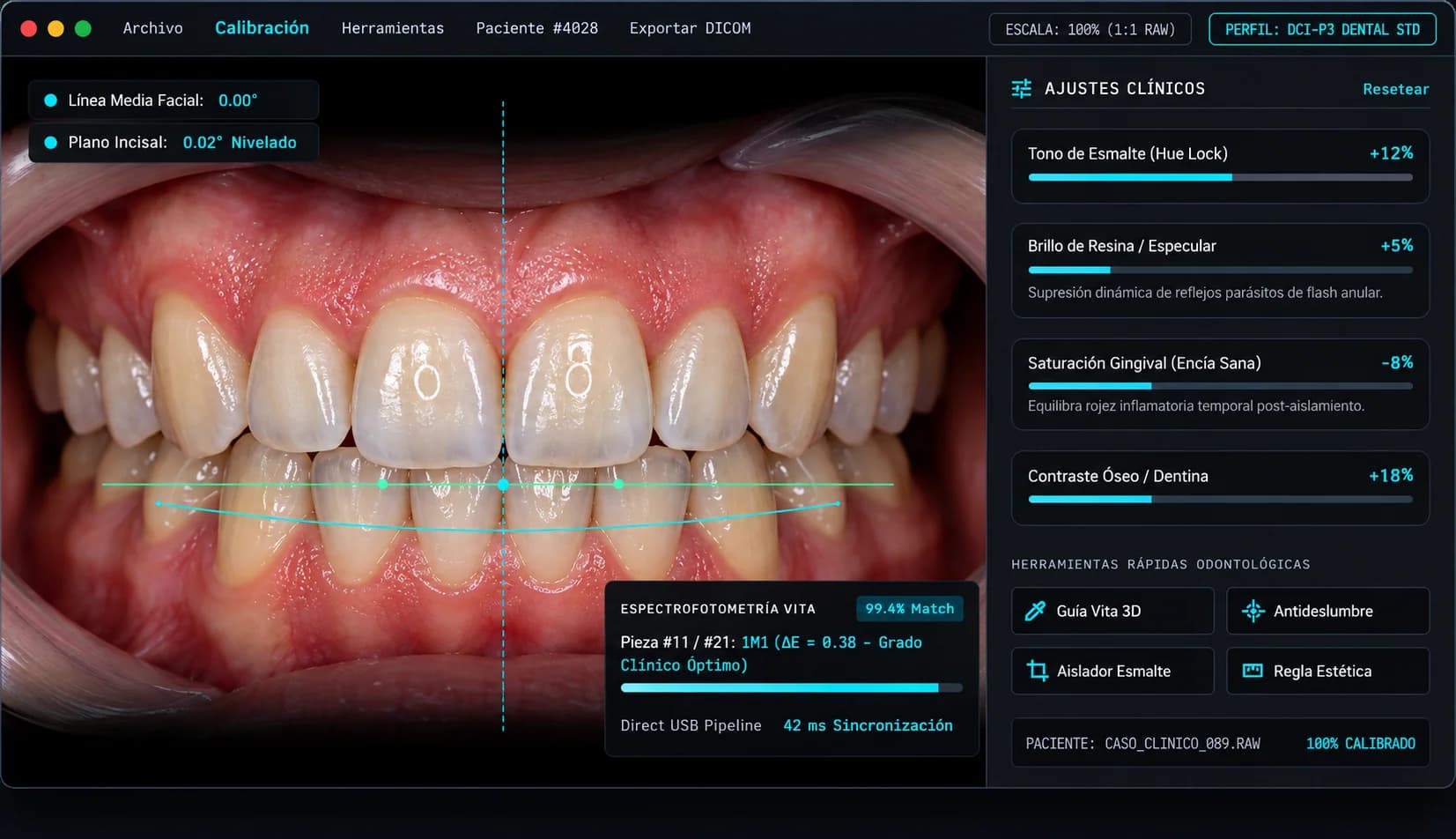 Interfaz de CaptureDental mostrando calibración clínica